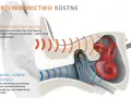 Ilustracja porównuje przewodnictwo kostne (drgania przez kości twarzy do ślimaka) ze zwykłym odbiorem dźwięku.